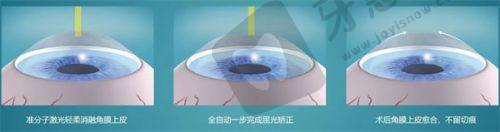 辽宁抚顺海睿眼视光预约挂号方式及流程
