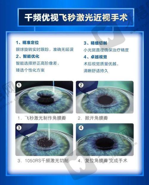 浙江衢州爱尔眼科医院价格体系与收费原则