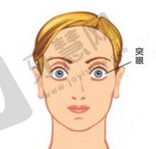 复旦大学眼科医院推荐医生