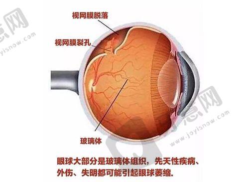 佰视佳眼科和普瑞眼科哪个好？医生技术、收费价格对比助你做选择