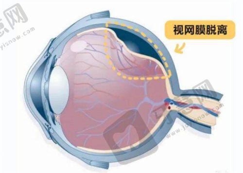 辽宁抚顺海睿眼视光特色项目及技术优势