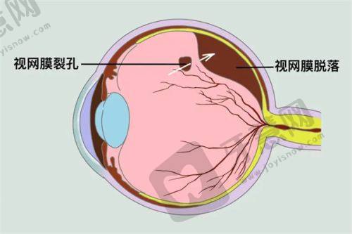 乌鲁木齐普瑞眼科医院总结推荐