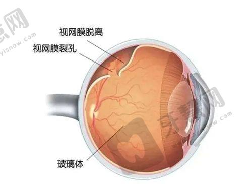 商丘视光眼科医院资质(正规性)