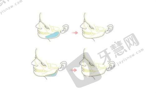 2025合肥前十整形医院大揭秘：含华美韩美，附地址及项目价格