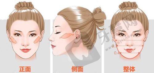 昆山惍鹰美贝薇医疗美容：昆山精细自然去痣的骨干医生