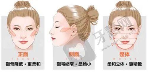 北京打玻尿酸的正规医院——北京丽合医疗美容医院