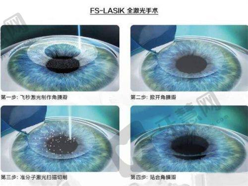 浙江衢州爱尔眼科医院预约方式全解析
