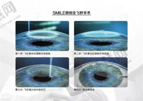 深圳新视代眼科医院医生团队实力强大
