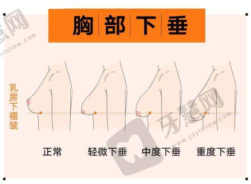 北京嘉禾李燕医生技术优势：专精不错的技艺保护