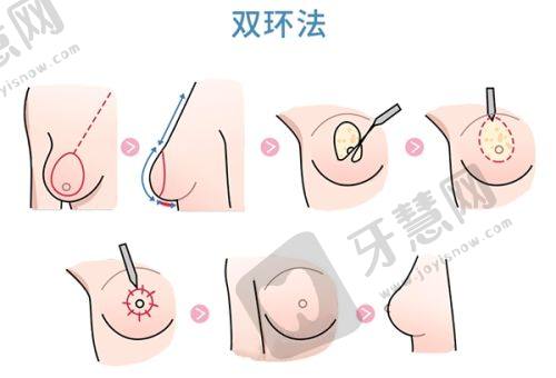 佛山曙光金子医学美容医院医生信息