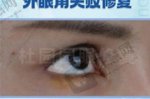 北京中圣颐安整形医院地址揭秘！海淀区院区交通指南及特色项目优势