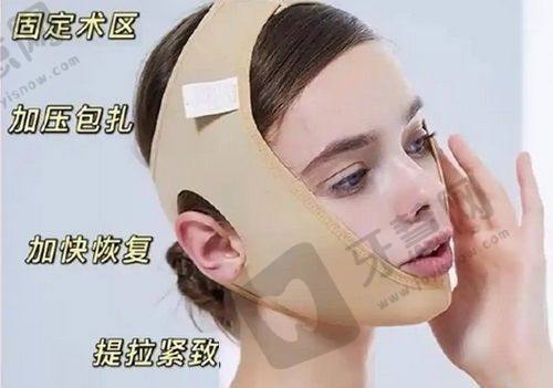 2022年5月想和朋友做美国viveve薇蜜缩阴术，其副作用有哪些？