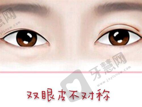北京杨俊和黄寅守拉皮手术和审美那个更好？杨俊微创拉皮、黄寅守V系列各有千秋