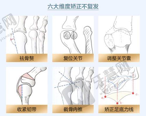 厦门祛斑医院选择的结尾建议