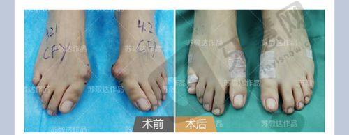 医生技术优势：解密北京杨俊和黄寅守拉皮手术核心亮点