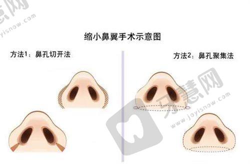 天津河东美莱医学美容医院