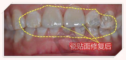 珠海六和口腔种牙特色亮点