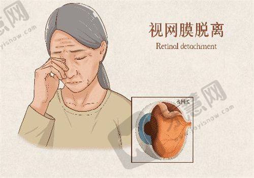 选择北京茗视光眼科崇文门院区的 3 大优势