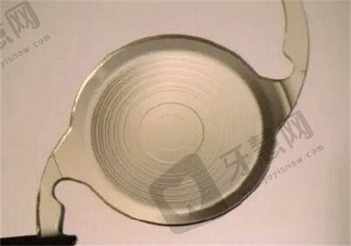 想了解滕州启明眼科医院眼底检查费用？200 - 2000元起！