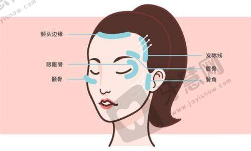 医生擅长项目：北京杨俊和黄寅守拉皮手术特色比拼