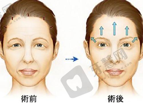 北京嘉禾李燕医生个人资料简介：实力与经验并存的整形骨干医生