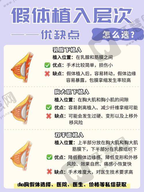 付国友医生大拉皮手术技术特点及出色成效