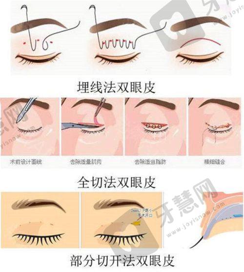 北京做拉皮好的医生排名榜之北京联合丽格第二医疗美容医院
