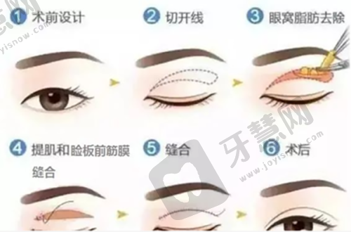 北京嘉禾李燕医生预约挂号方式