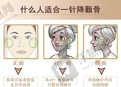 了解武汉天佑双眼皮更多信息的引导