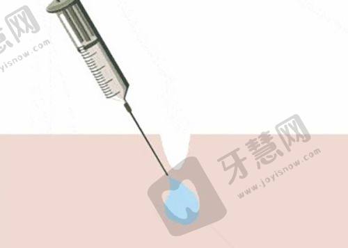 厦门祛斑收费价格明细参考