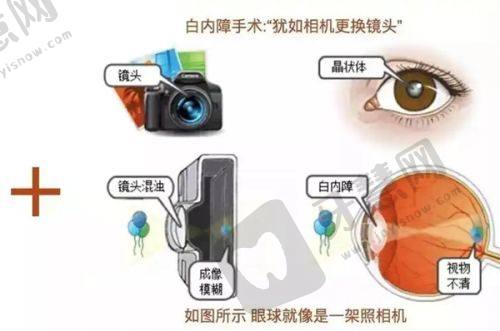 北京嘉禾孙景波医生技术优势：不错技艺塑造美眼