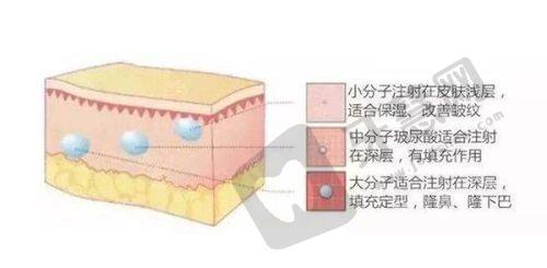 北京嘉禾李燕医生技术优势：精细微创，个性化定制