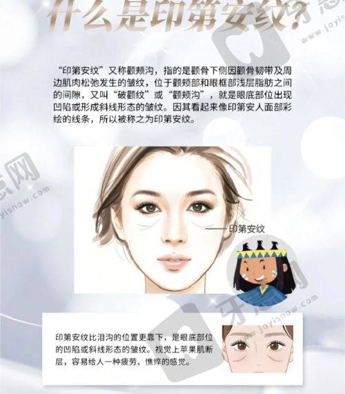手术后的护理:美国viveve薇蜜缩阴手术术后保养