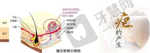 不错技艺，成就理想眼部修复——北京李燕医生技术优势
