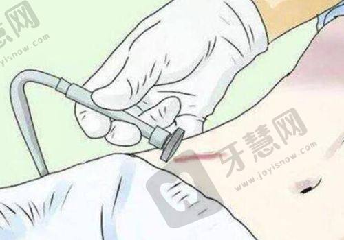 北京馒化修复医院医生推荐：北京奥尔贝德医疗美容