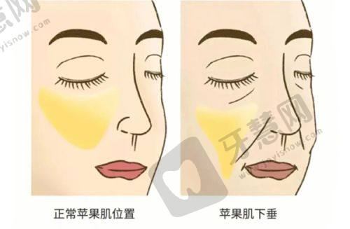 精细雕琢，重塑美丽双眸——北京李燕医生擅长项目