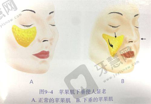 北京馒化修复医院医生推荐：北京艺星整形美容医院