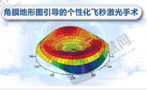 2025爱尔眼科费用价目大揭秘，多项目价格参考及医院优势解读