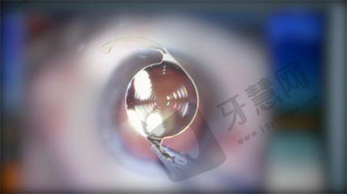 北京茗视光眼科崇文门院区 3 种便捷预约挂号方式