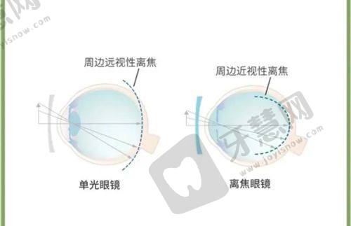 长春一诺眼科医院全揭秘：资质、设备、价格、口碑全知晓！》