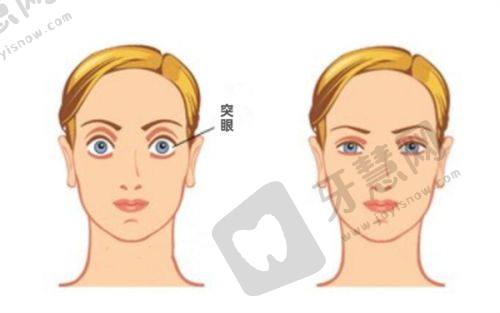 滕州启明眼科医院眼底检查总结