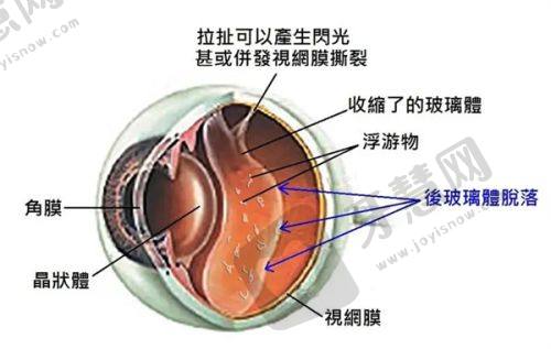 北京首大眼科医院人气医生招牌手术项目及简介