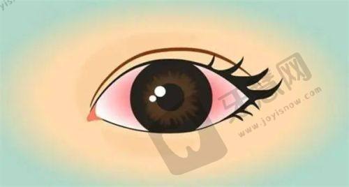 兰大二院眼科网上预约挂号总结呼吁