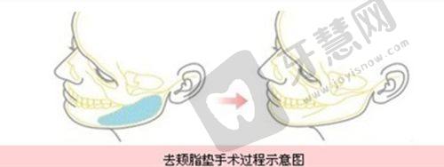 医生审美对比：北京杨俊和黄寅守自然与协调的不同诠释