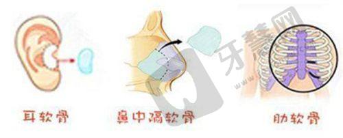 2024推荐武汉华美付国友做拉皮，技术靠谱价2 - 6万，效果好恢复快