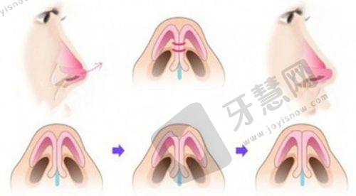 北京嘉禾李燕医生最擅长什么？眼部与私密整形，技术优价格明，北京嘉禾坐诊
