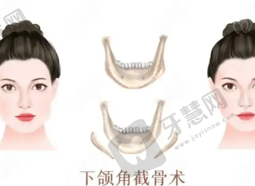 北京张笑天改脸型医院正规性