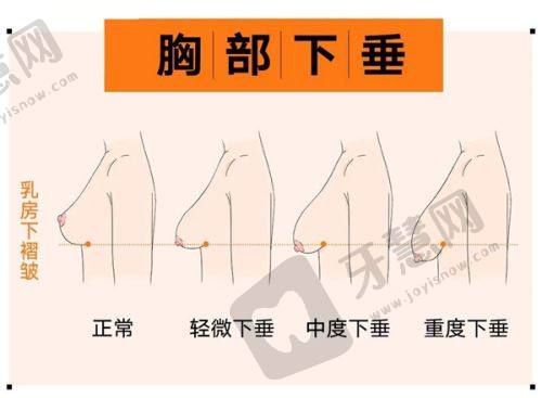 北京下巴磨骨手术价格