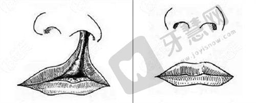 兰州市第一人民医院 - 皮肤科