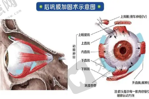 不同档次玻尿酸价格